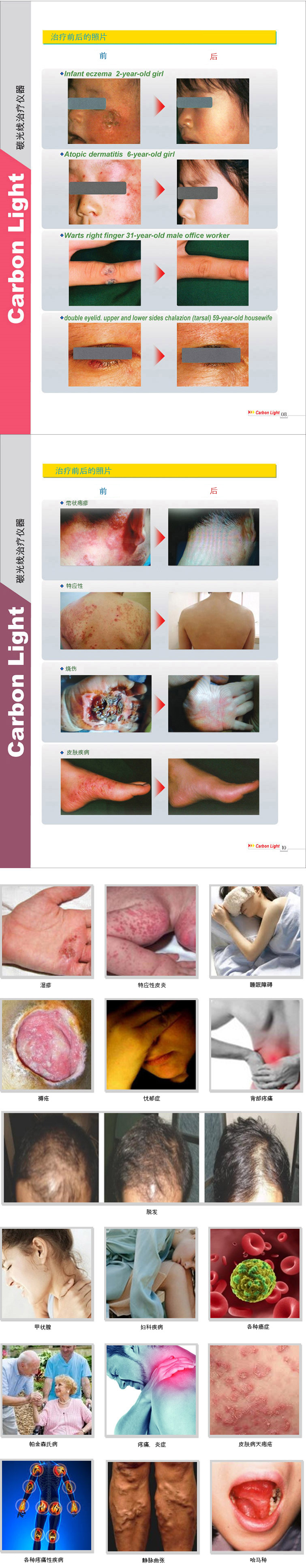 Visible light treatment before and after