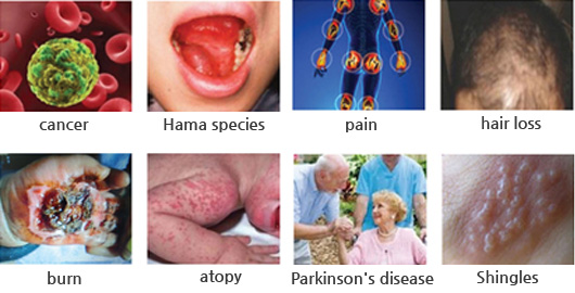 CARBON LIGHT KG-CL001