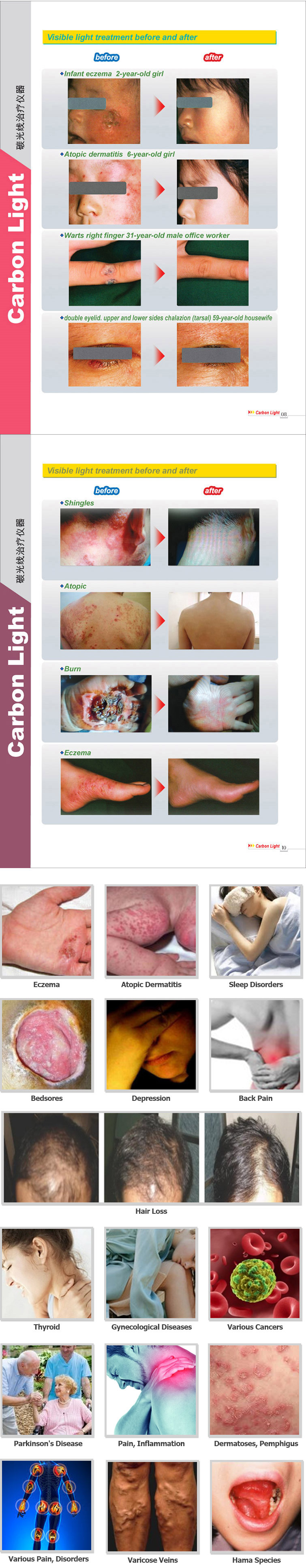 Visible light treatment before and after