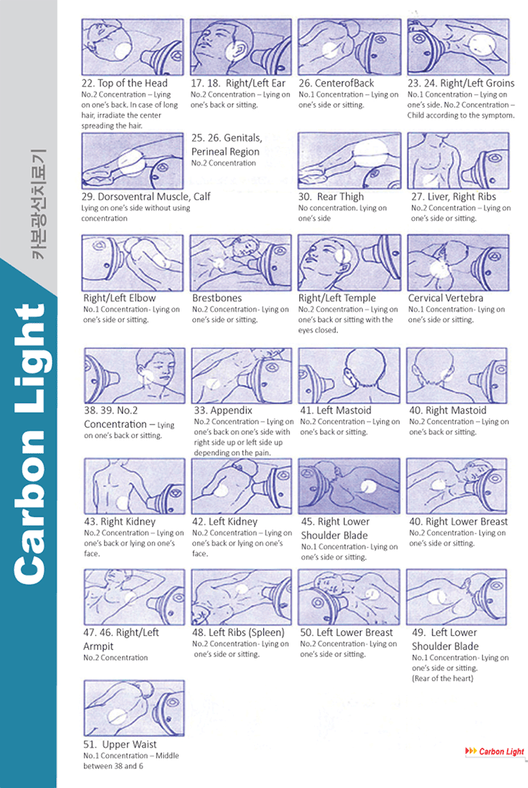 Description of Pictures of Parts to be Irradiated